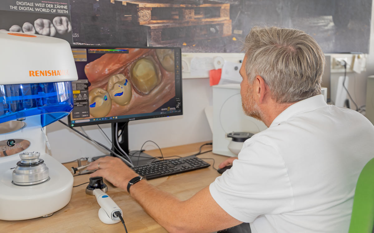 Laborfähiger Intraoralscan.